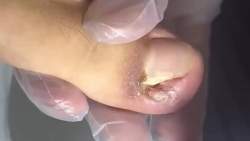 8104528 B