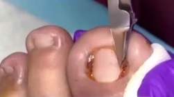 5322981 B