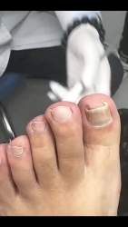 6551239 B