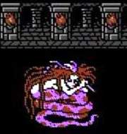 11332 B