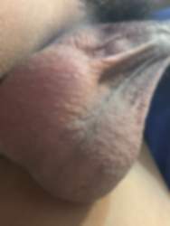 176517 B