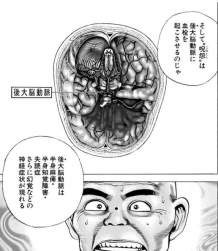 58844 B