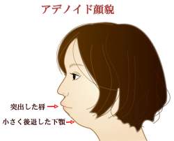 71668 B
