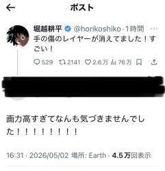 75581 B