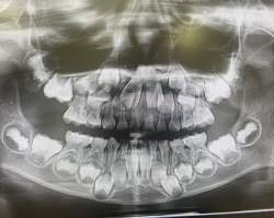 108681 B