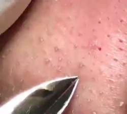 2846766 B