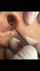 5747262 B