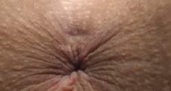 1106232 B