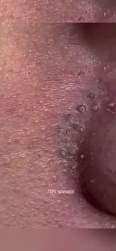4384279 B