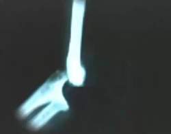 2519068 B