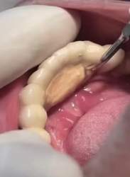 2286390 B