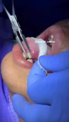 2556974 B