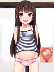 311775 B